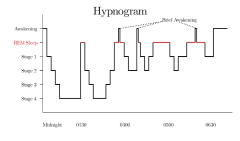 Hypnogram Chart